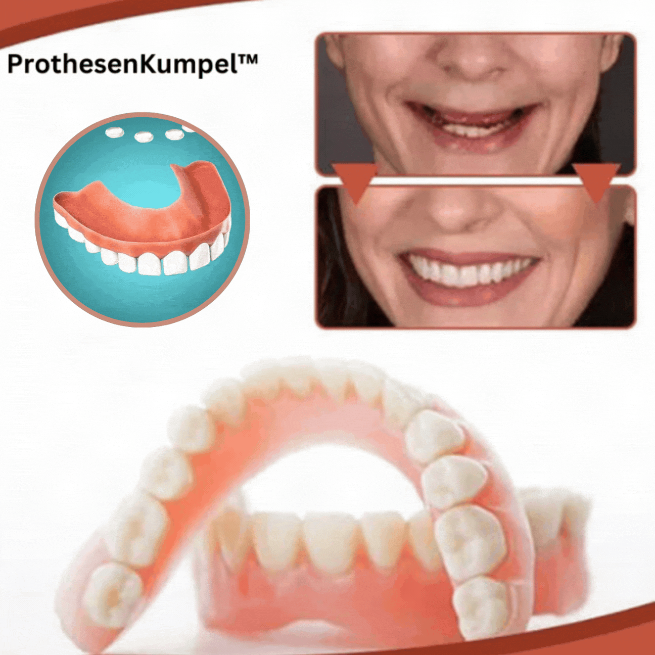 BowLift | Biocompatible  Prosthesis Set for Pain-Free Fit and Natural Smile