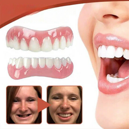 BowLift | Biocompatible  Prosthesis Set for Pain-Free Fit and Natural Smile